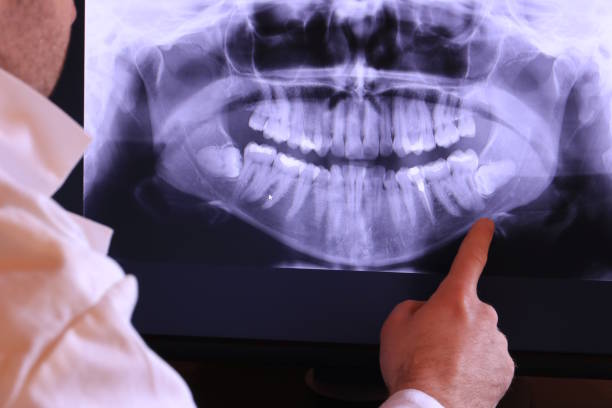 Best Chipped Tooth Repair Near Me  in Cuero, TX